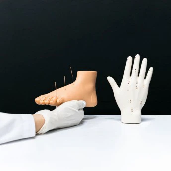 Acupuncture Therapy (with Moxibustion)
